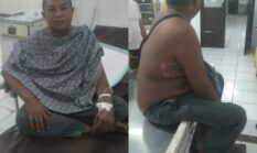Jurnalis Berinisial SM Alias Samiun Jadi Korban Panah Wayer di Girian, Pemkot dan APH Didesak Bertindak Tegas